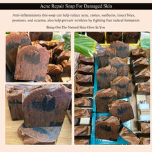 Load image into Gallery viewer, Acne Repair Soap for damaged skin: This soap made with natural ingredients that will heal your skin and leave you with a flawless glow.
Our Acne Repair Soap have many skin benefits including. Clears acne with salicylic acid-Moisturizes the skin-Helps reduce pigmentation from past breakouts- Promotes an even skin tone- Hydrates dry skin- Repair damaged skin- Offers anti-inflammatory properties.
It also helps with common skin problems such as eczema, contact dermatitis, hyperpigmentation, sun burns,