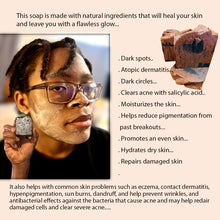 Load image into Gallery viewer, Acne Repair Soap for damaged skin: This soap made with natural ingredients that will heal your skin and leave you with a flawless glow.
Our Acne Repair Soap have many skin benefits including. Clears acne with salicylic acid-Moisturizes the skin-Helps reduce pigmentation from past breakouts- Promotes an even skin tone- Hydrates dry skin- Repair damaged skin- Offers anti-inflammatory properties.
It also helps with common skin problems such as eczema, contact dermatitis, hyperpigmentation, sun burns.
