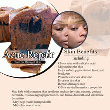 Load image into Gallery viewer, Acne Repair Soap for damaged skin.